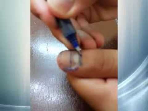 بالفيديو أسهل طريقة لعلاج ألم الأسنان