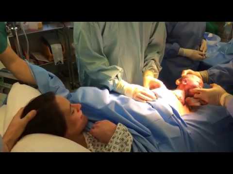 إنجليزية تلد قيصري طبيعي في نفس الوقت