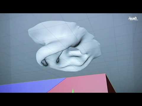 زراعة قوقعة الأذن يخفف أعراض الاكتئاب