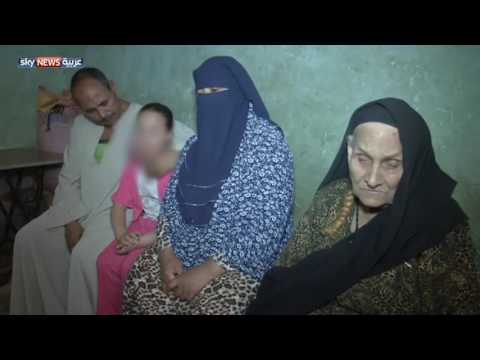 مريم تعاني من ورم خطير في الوجه