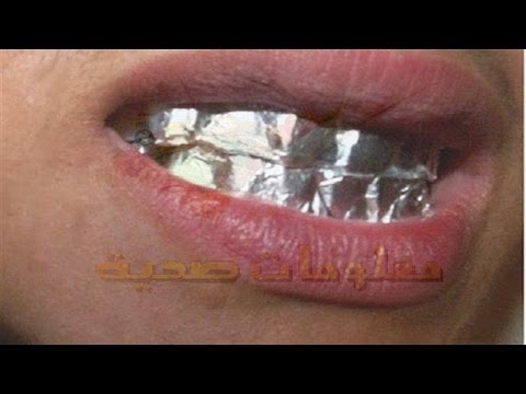 طريقة سحرية تمنحك أسنانا بيضاء