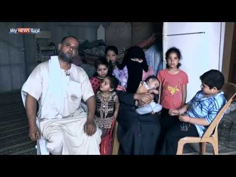 شاهد علاج مُعيل ينتظر الدعم