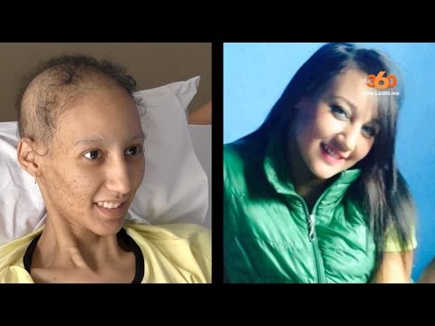 فيديو حنان تحكي قصتها مع مرض السرطان وهذه رسالتها