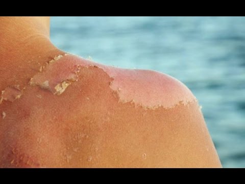 بالفيديو  نصائح هامة لحماية البشرة في فصل الصيف