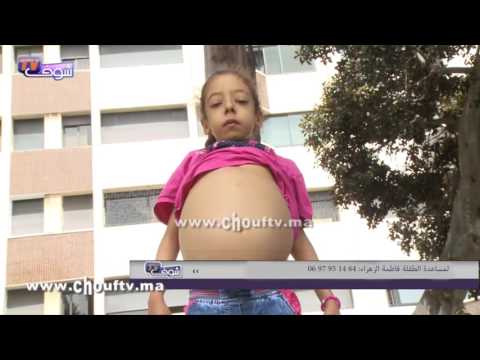 شاهد أم تطلب المساعدة في علاح ابنتها من الكبد