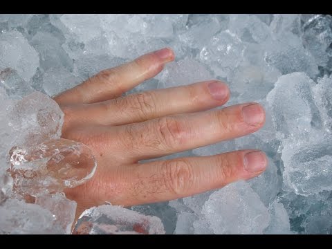 فيديو خطأ شائع نقع فيه دائمًا وهو وضع الثلج على الحروق