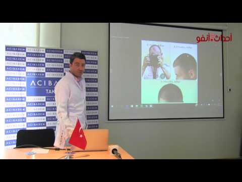 مشاهير في عالم الكرة والغناء قاموا بعملية زراعة الشعر