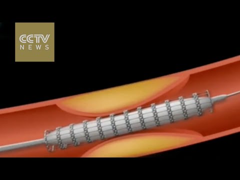 يالفيديو  علماء كوريا الجنوبية يصنعون إنسانًا آليًا لقتل مرض السرطان