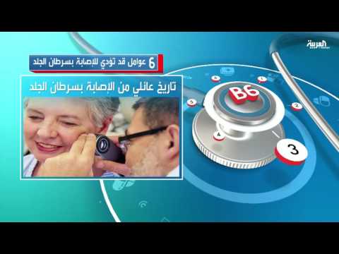 6 عوامل تؤدي للإصابة بسرطان الجلد