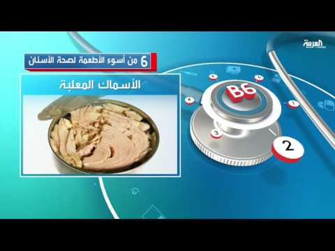 بالفيديو 6 من أسوء الأطعمة لصحة الأسنان