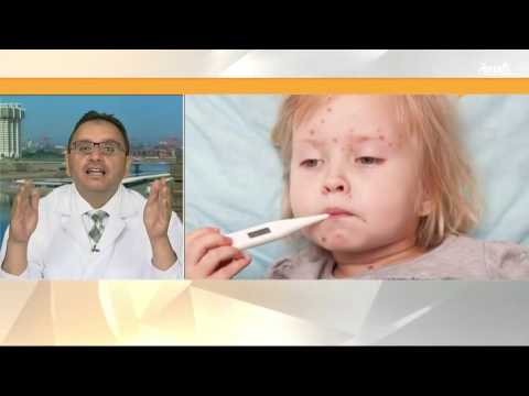 دراسات طبية وعلماء يؤكدون أن الإنفلونزا قد تكون مميتة