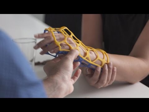 طريقة جديدة لمعالجة الكسور