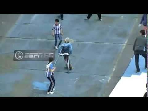 شاهد مهارة مذهلة لطفل بساق واحدة