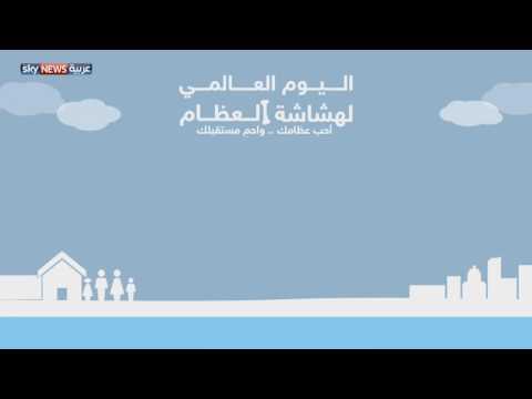 العالم يحتفل باليوم العالمي لهشاشة العظام