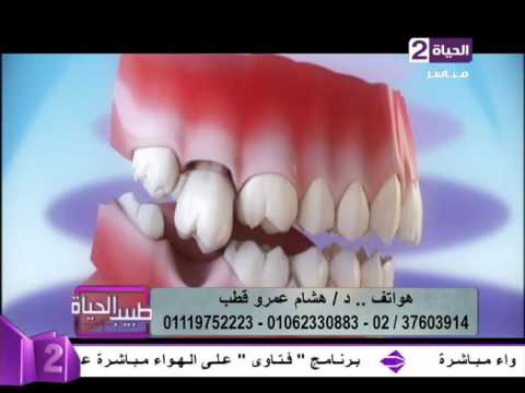 تعرف على تساقط الأسنان