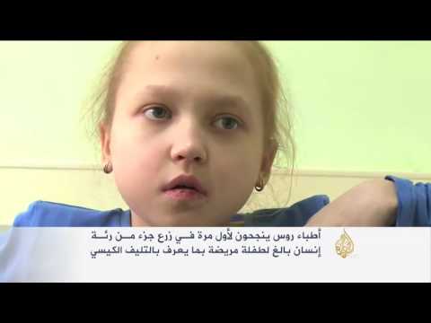 نجاح عملية لزراعة جزء من رئة إنسان