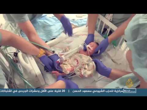 بالفيديو إنسان يولد مرتين في ولاية هيوستن الأميركية