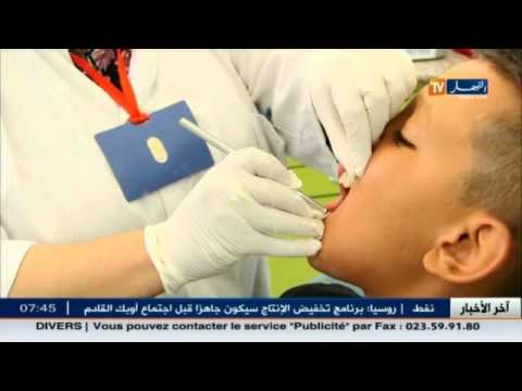 شاهد77 في المائة من الأطفال مصابون بالتسوس