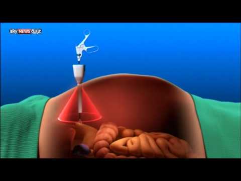 تقنية حديثة لإجراء العمليات الجراحية في المغناطيس