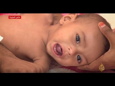 شاهد الوضع الإنساني في تعز يزداد سوءًا يومًا بعد يوم