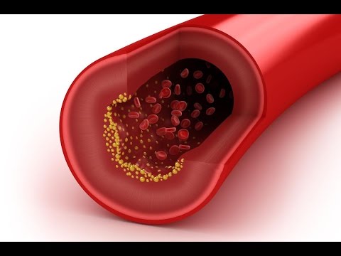 شاهد كيف نخفّض مستوى الكوليسترول في الدم