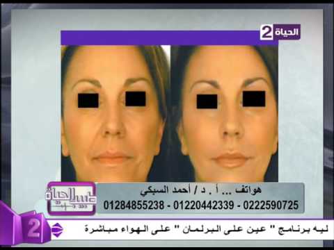 حقن الوجه بالفيلر بدون بنج أو ألم