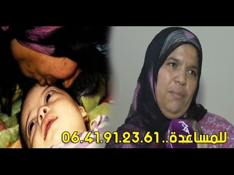 شاهد مريضة تحتاج إلى مساعدة لإجراء عملية جراحية