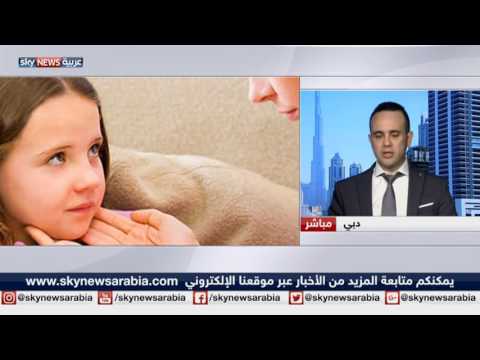 شاهد الجهاز المناعي يتأثر بالتهاب اللوزتين