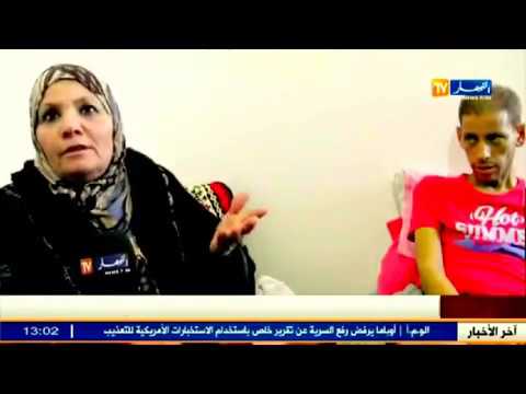 مرض نادر ينخر جسد بومدين من المسيلة