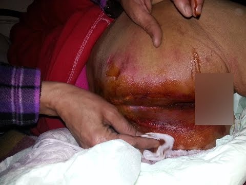 المغاربة غاضبون بعد تكرار وفاة المُسنين في أزرو