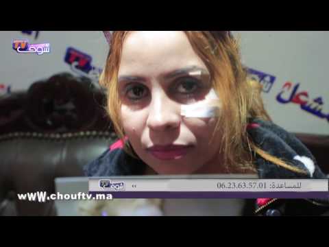 قبل وبعد التعرض إلى عمليات التجميل