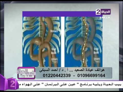 الفرق بين عملية تحويل المسار القديمة والحديثة