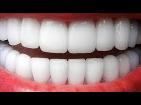 شاهد وصفة سهلة لتبييض الأسنان خلال دقيقتين