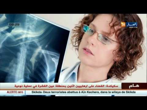 شاهد أسباب ظهور الدوالي وهكذا نقضي عليها