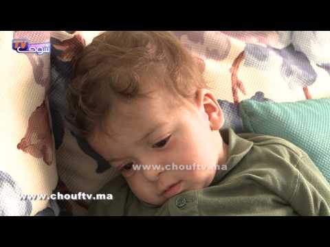 شاهد طفل مغربي يحتاج إلى عملية جراحية سريعة