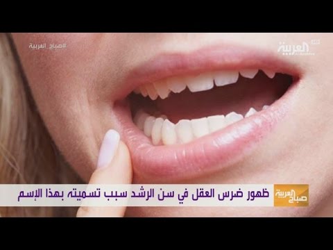 عدم توفر مساحة في الفم من أبرز مشاكل ضرس العقل