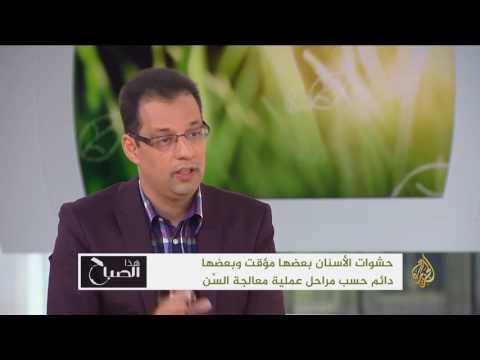 شاهد الدكتور عقبة القاسمي يتحدث عن حشوات الأسنان