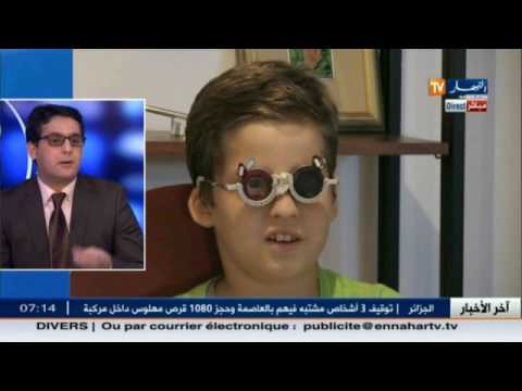 تطوّر طب العيون في الجزائر وسط تردّد المرضى