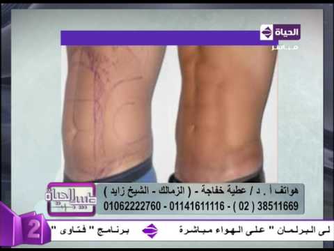 نتائج مبهرة بعد التخلّص من السمنة الزائدة