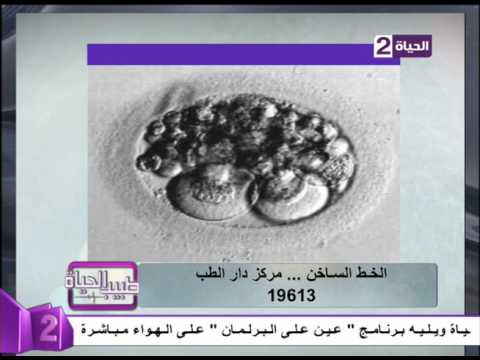 شاهد ماهي أنواع الأجنة 