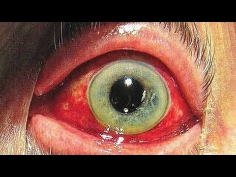 شاهد 5 أمراض بشرية فشل العلم في تفسيرها