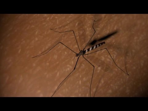 شاهد  مرض عصره الملاريا