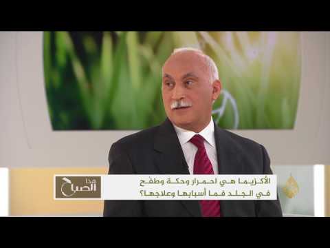 عادل كمال يؤكّد أن الأكزيما تشمل العديد من الأمراض الجلدية