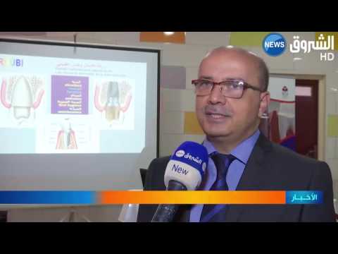 شاهد تقنية جديدة لزراعة الأسنان دون جراحة