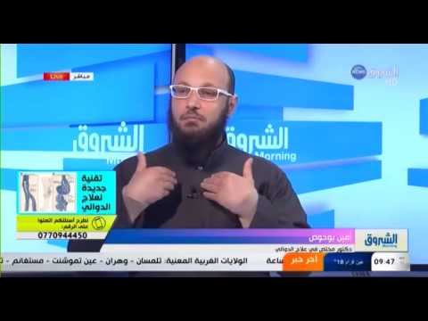 تقنية جديدة وفعالة لعلاج الدوالي
