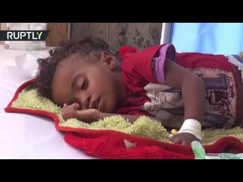 الكوليرا تفتك بأكثر من 100 يمني وتصيب الآلاف