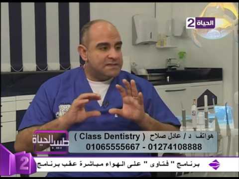 ما هي الابتسامة اللثوية وكيفية علاجها