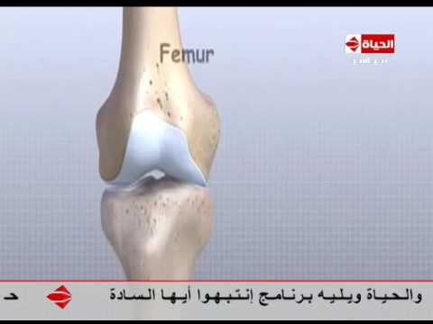 شاهد مقطع يستعرض مفصل الركبة وكيفية إصابته
