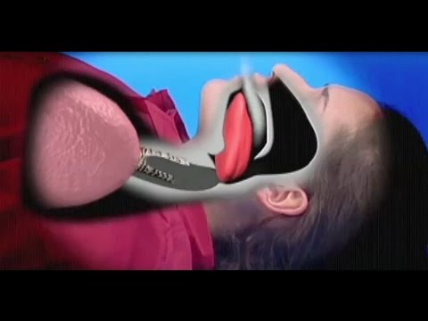 شاهد كيفية إنقاذ شخص بلع لسانه بشكل مفاجئ