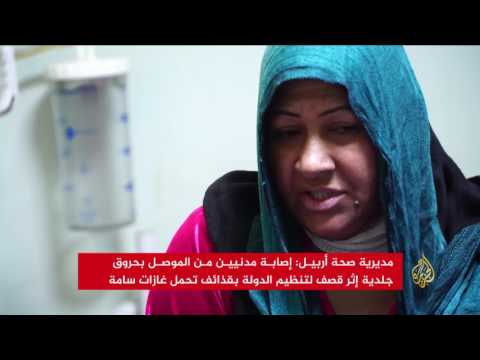 بالفيديو إصابة مدنيين من الموصل بحروق كبيرة إثر قصف لـ داعش